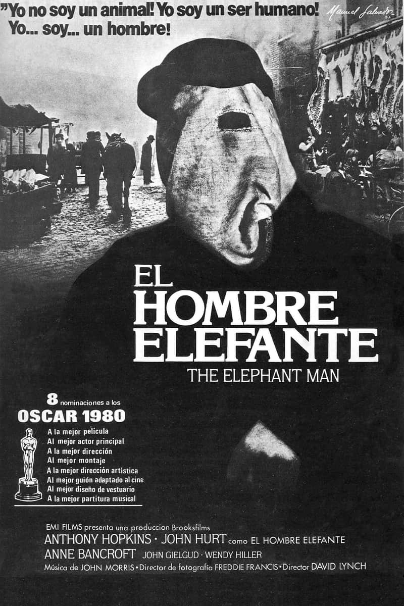 El hombre elefante